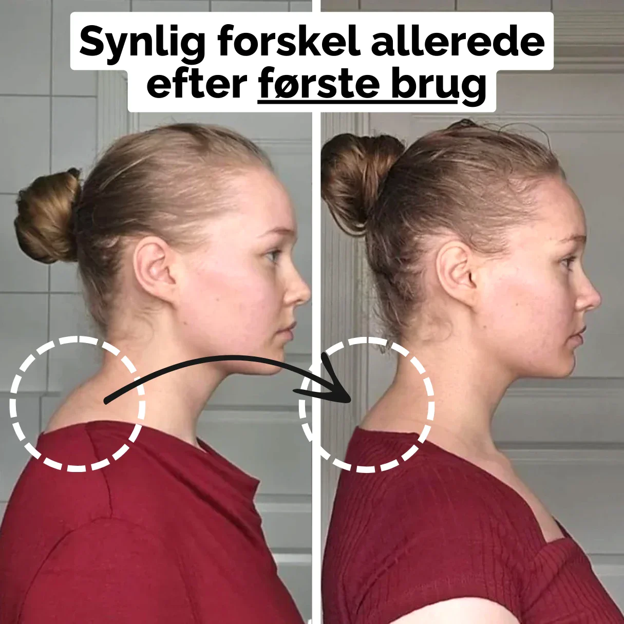 ACUFlex - Nakkestrækker med akupressur - Image 5