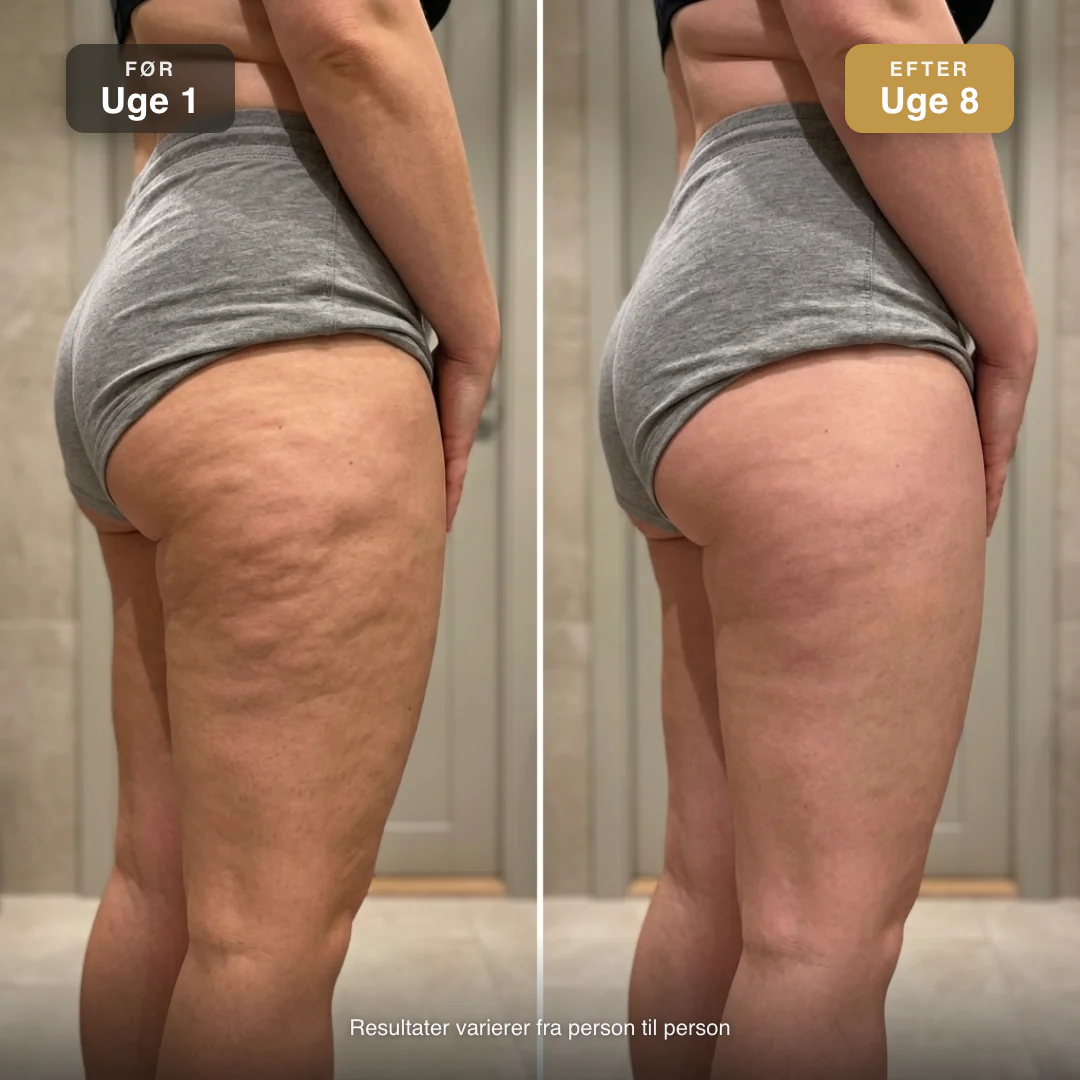 AVA CelluSculpt™ Anti-Cellulite Massageapparat - Image 5