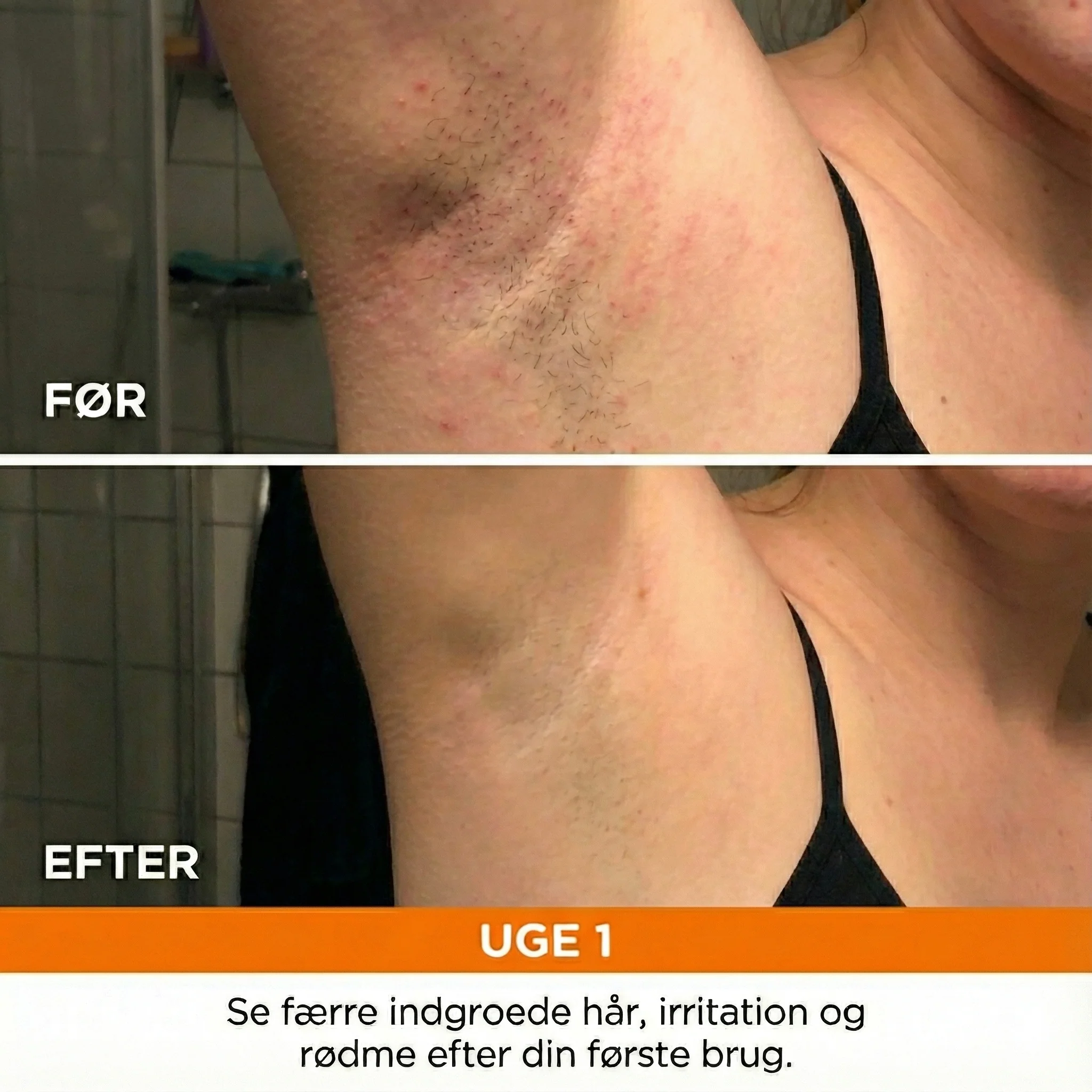 IPL Anti-hårvækst Serum - Image 2