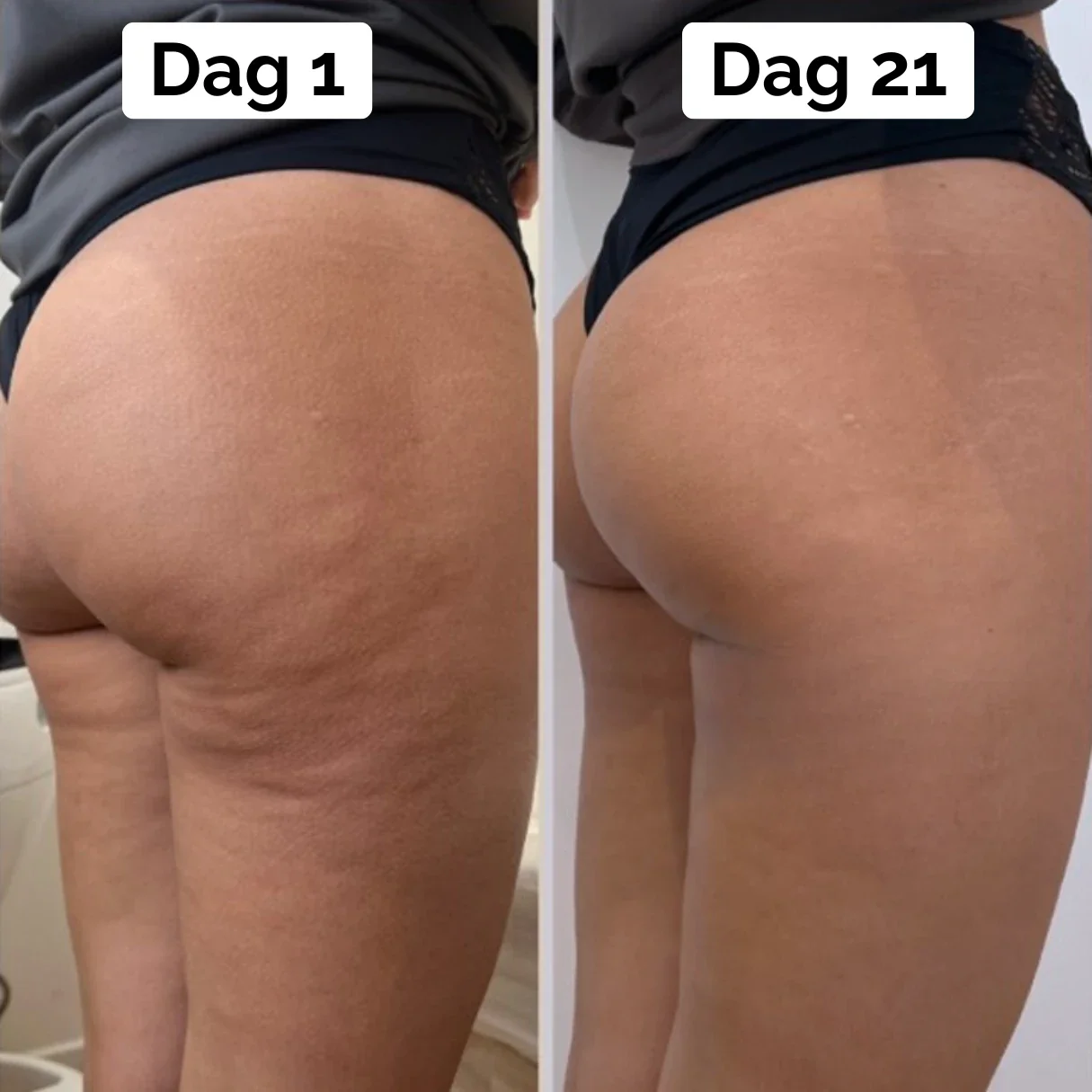 BodyTone Duo (PAKKETILBUD) - Image 7