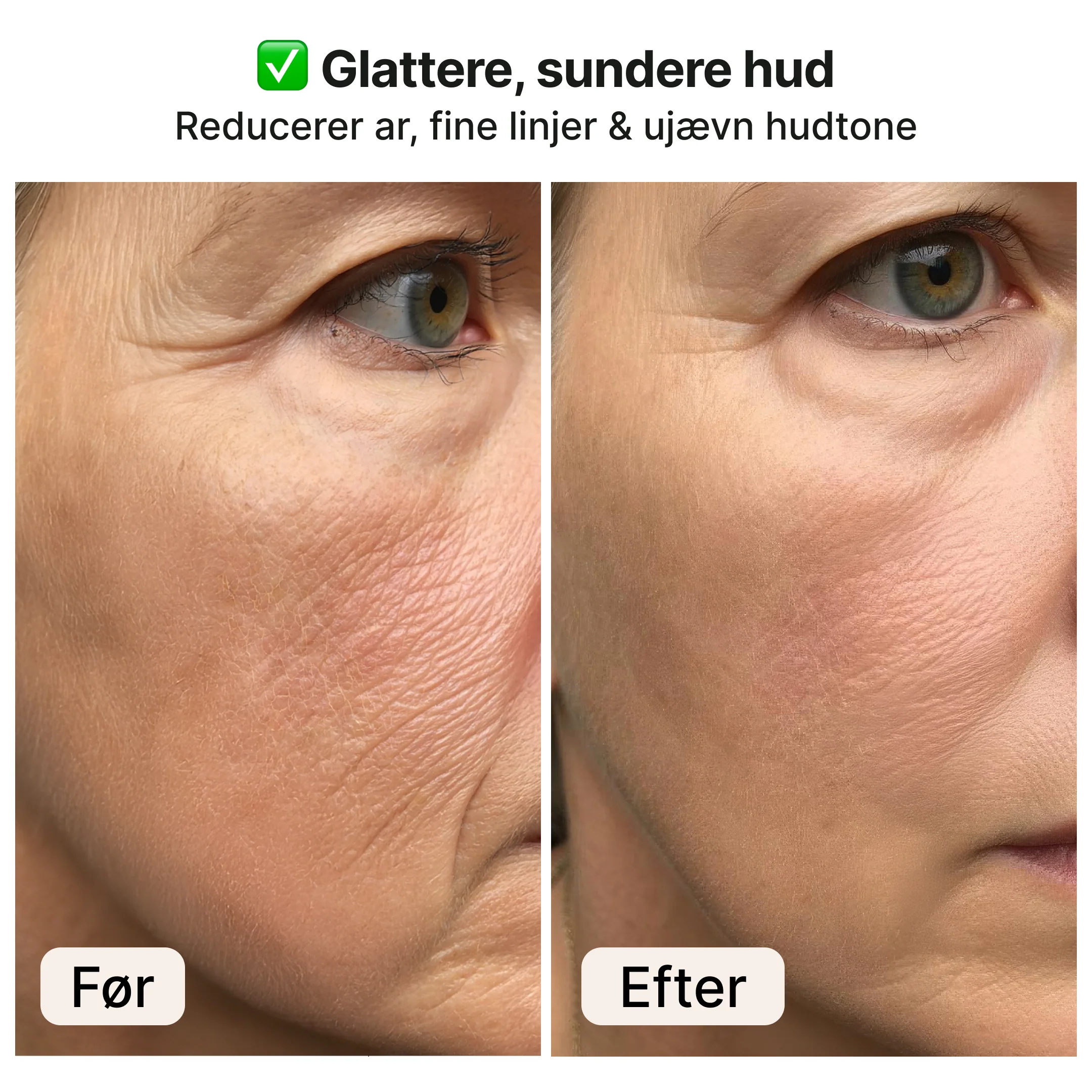 Derma stamp – Mikronåle til hud og hårvækst - Image 4