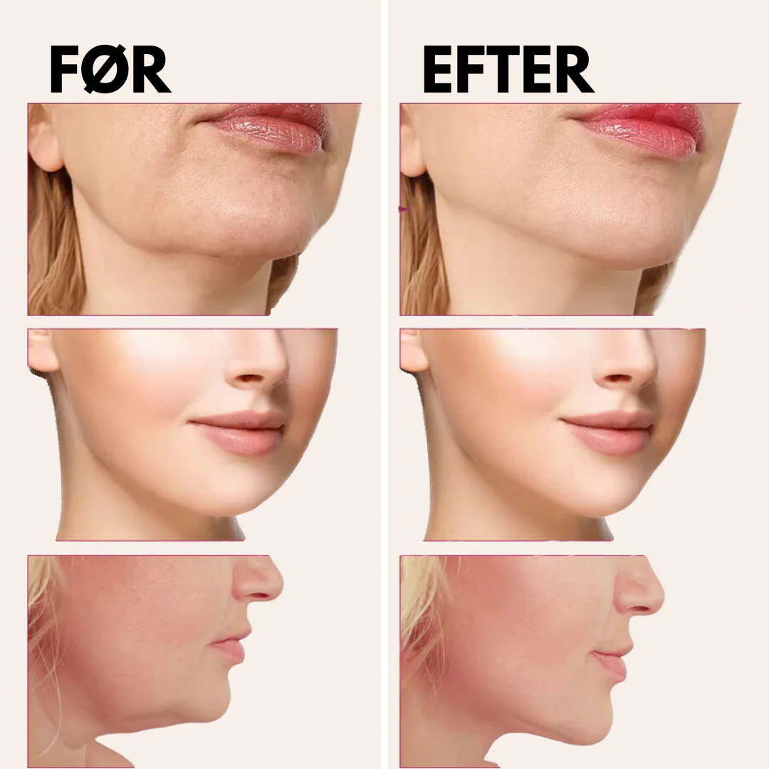GlowSculpt EMS Facial Massager - V-Form Lift med mikrostrøm og anti-age effekt - Image 4