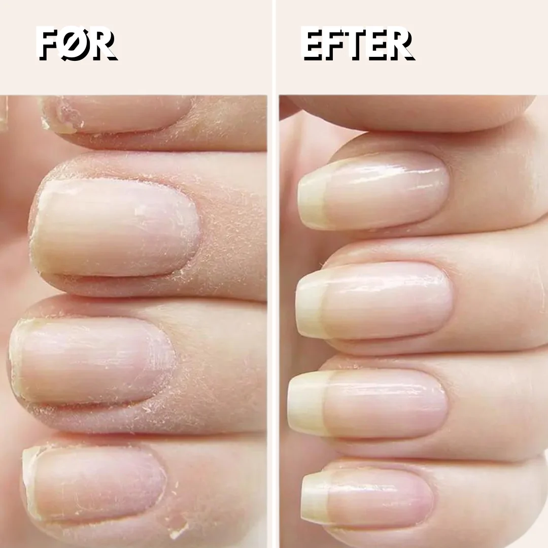 GlamTrim™ Elektrisk negletrimmer - Få perfekt plejede negle med sikker skånsom trimning - Image 4