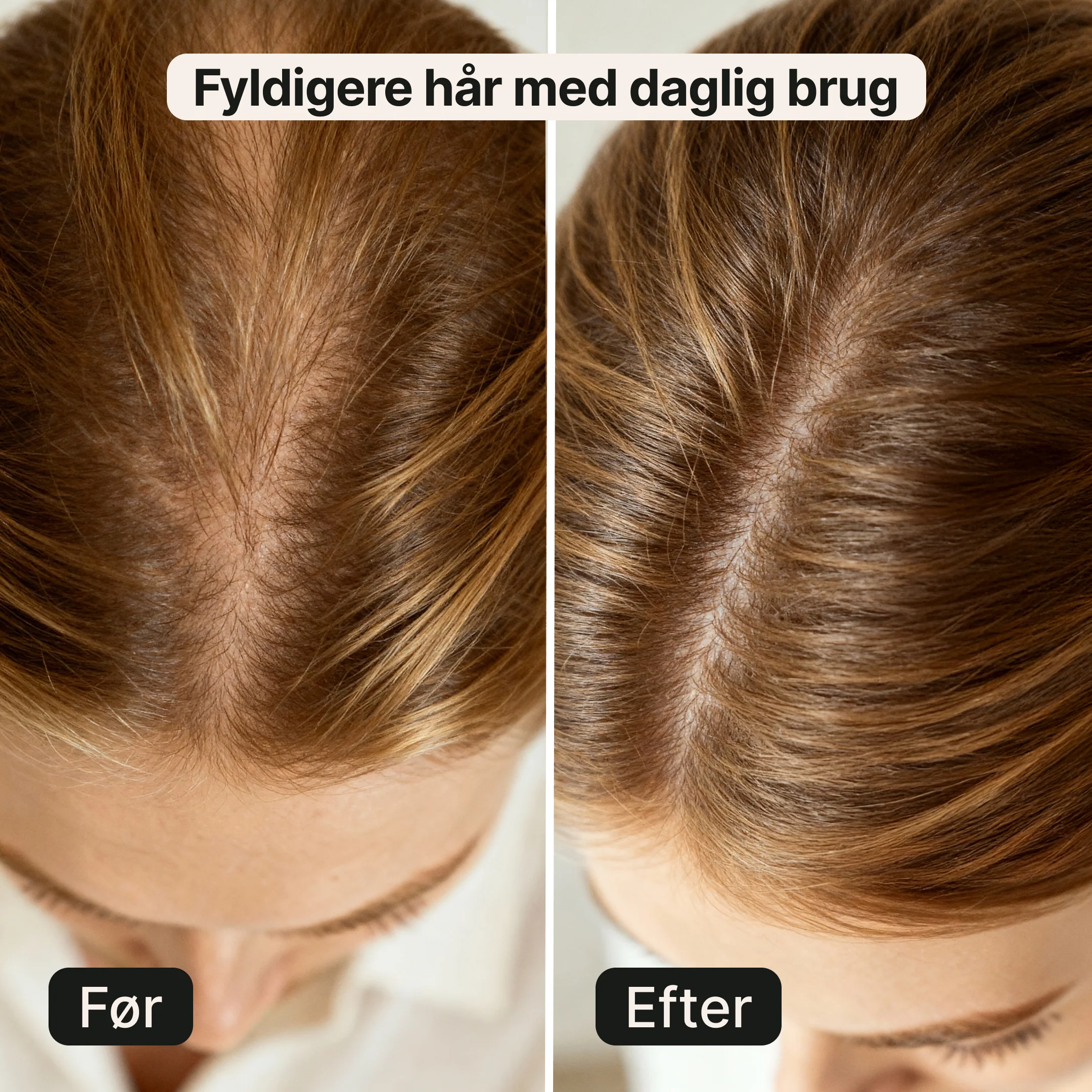 LED Hårplejehat – Til tyndt hår - Image 3