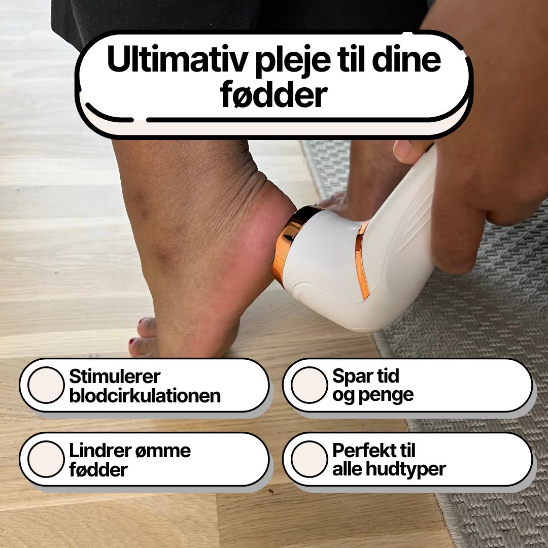 SoleCare Elektrisk Fjerner til Hård Hud - Image 5